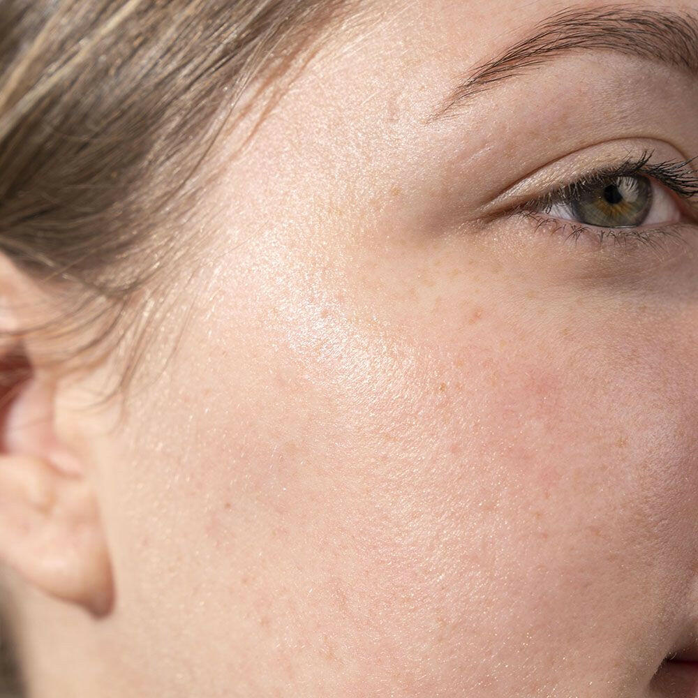 Multi-Functional Peel 30ml